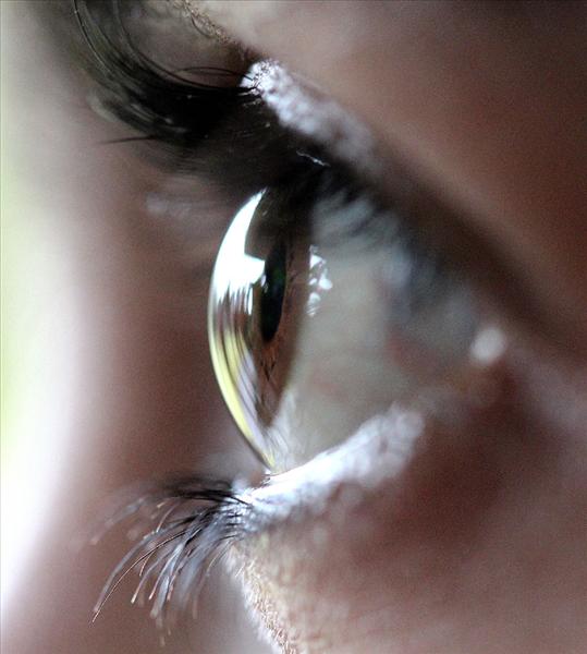 Vision